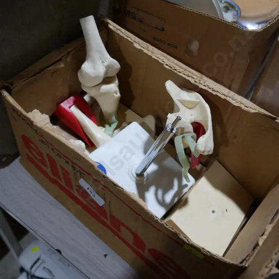 Medical display joints